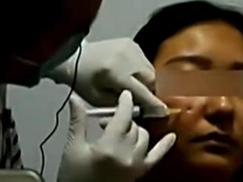 记者卧底暗访美容培训机构,微整形美容骗局有哪些呢