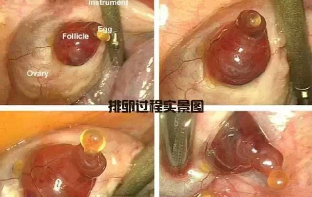 造人计划之前必须要做的几件事,造人是个很辛苦的事情