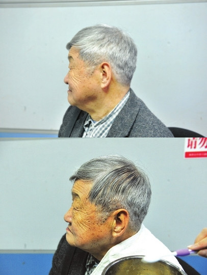 用土豆皮怎么染黑发,土豆能让白发变黑发吗