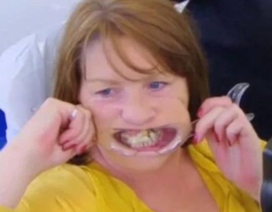 脑洞真大！英国女子为省钱竟然用502粘断牙