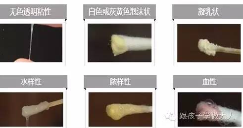 孕期白带查出革兰阴性杆菌,孕期白带检测有红细胞