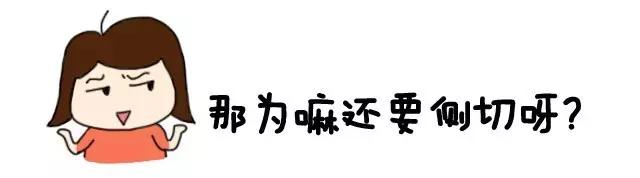 都什么年代了，还有常规侧切？