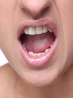 口腔溃疡接吻传染梅毒,接吻会传染口腔癌么