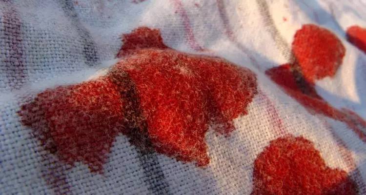 去黄渍神器,白衣去渍神器