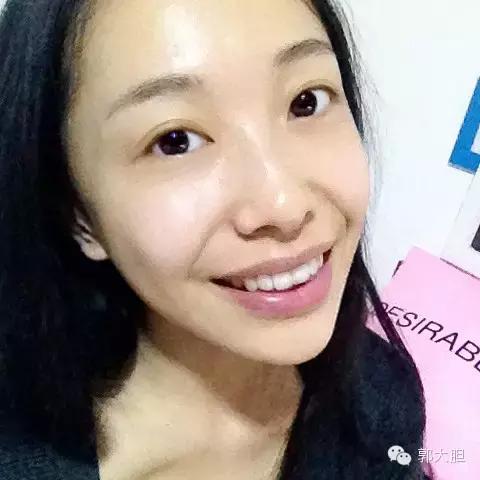 缺一颗门牙能戴隐形牙套吗,门牙龅牙医生建议磨小戴牙套