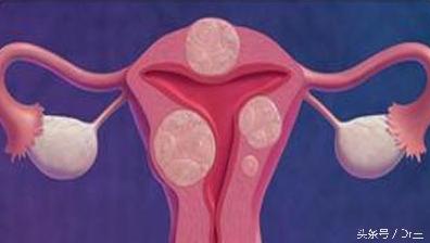 经血过多会导致哪种贫血,经血特别多出现血崩