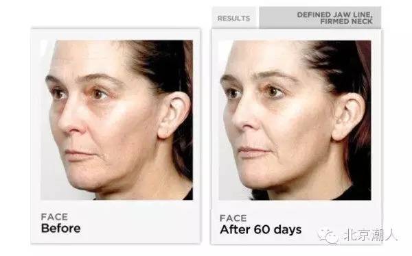 美容仪在家做的步骤,家用美容仪如何达到医美效果