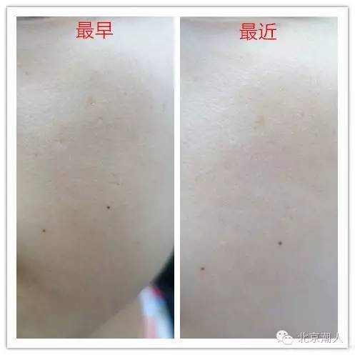 美容仪在家做的步骤,家用美容仪如何达到医美效果