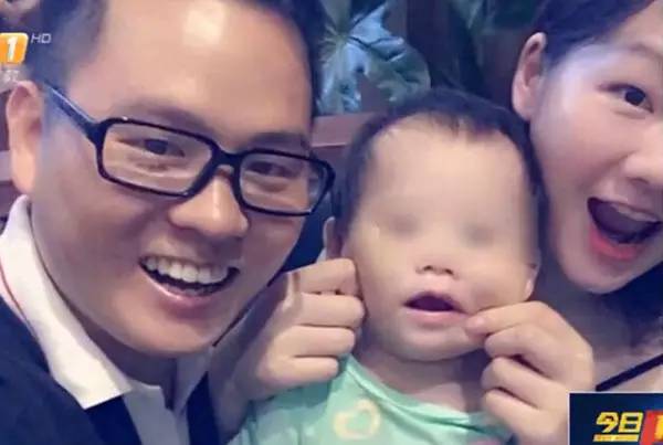 心疼女孩用酒精消毒却被意外烧伤,心疼受伤的女孩