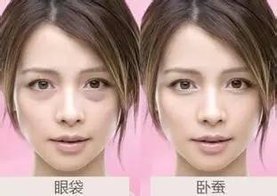 眼袋和卧蚕你还傻傻分不清楚吗,一张图告诉你卧蚕和眼袋的区别