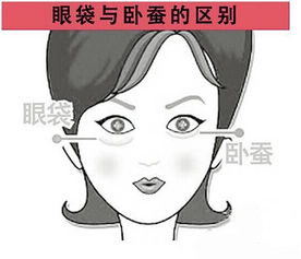 眼袋和卧蚕你还傻傻分不清楚吗,一张图告诉你卧蚕和眼袋的区别
