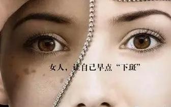 色斑和色素有什么区别,色斑和色斑区别
