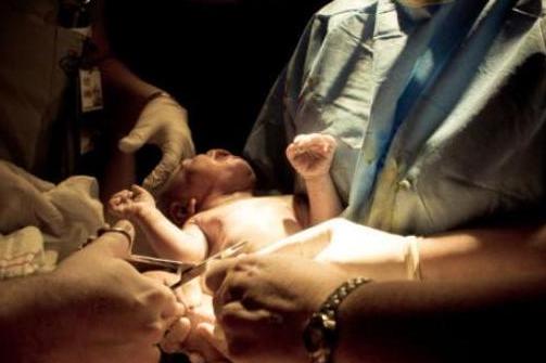 剖腹产的女人请好好珍惜,剖腹产女人要受多少罪