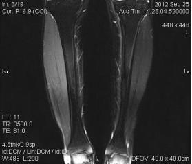 电大夫,电疗医生是谁