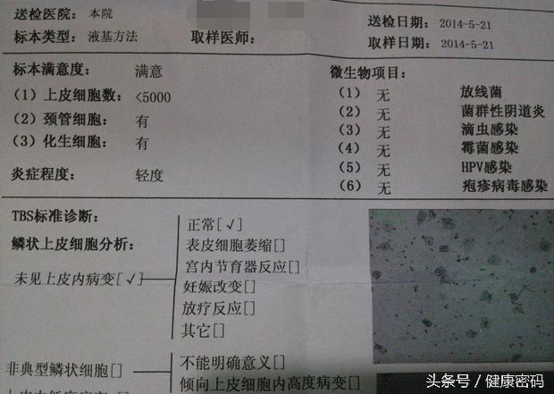 子宫检查报告单如何看,妇科子宫颈刮片是怎么检查的