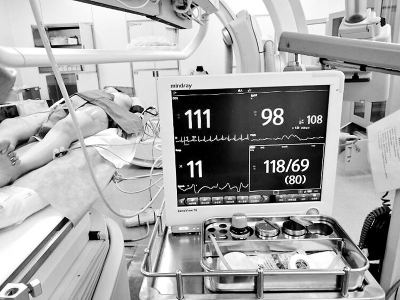 熊猫血生孩子一般可能大出血吗,熊猫血妈妈大出血概率