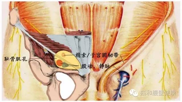 腹股沟疝气是不是只有一个睾丸,腹股沟疝气双侧9mm