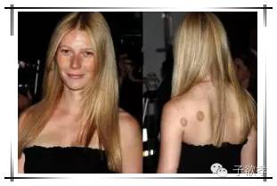 里约奥运会开幕式点燃火炬,里约奥运会拔火罐