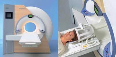 小脑扁桃体下疝畸形最佳治疗方法,小脑扁桃体下疝畸形手术治疗