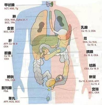 常规体检不建议筛查肿瘤,为什么体内肿瘤无法体检出来