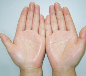 原来出汗也很治愈,原来出汗现在不出汗怎么回事