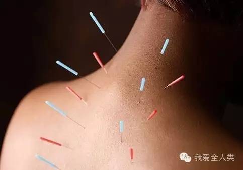 别再折腾拔罐了，中国还有其它好东西呢