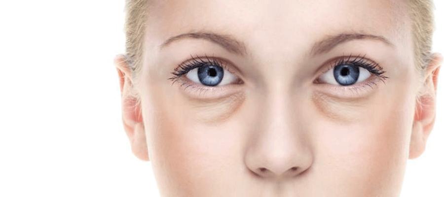 眼袋和卧蚕和泪沟的区别,你能不能搞清楚自己需要的是什么