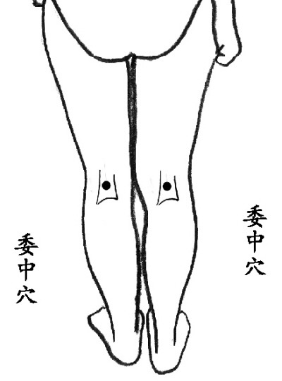 腰椎痛按委中穴,委中穴可以治疗腰椎间盘突出吗