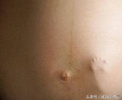 孕18周有胎动要开始数胎动吗,18周孕妇怎么感觉到胎动