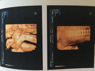 四维终于顺利通过了3次,四维顺利通过但是胎动还是不明显