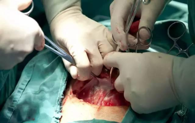 剖腹产必须知道的9个方面,剖腹产怎么才能轻松点