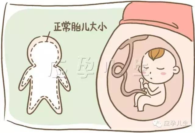 准妈妈如何在生活中避免出现难产,每个怀孕的女人都会害怕怎么缓解