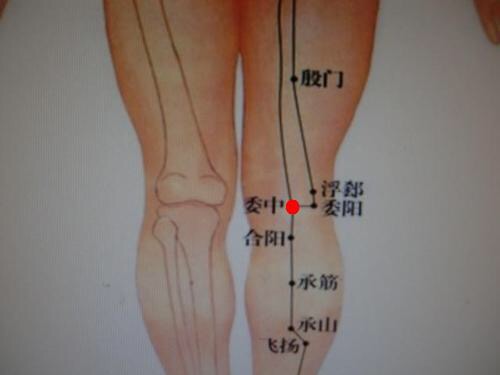 腰椎痛按委中穴,委中穴可以治疗腰椎间盘突出吗
