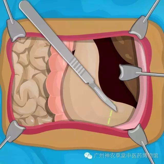 中医不懂解剖学,中医经络穴位解剖学