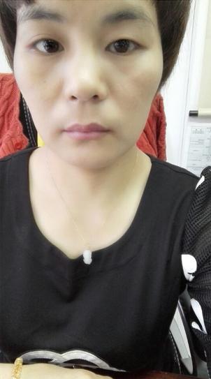 皮肤暗黄有斑点用什么祛斑产品除,天生有斑点祛斑最有效的方法