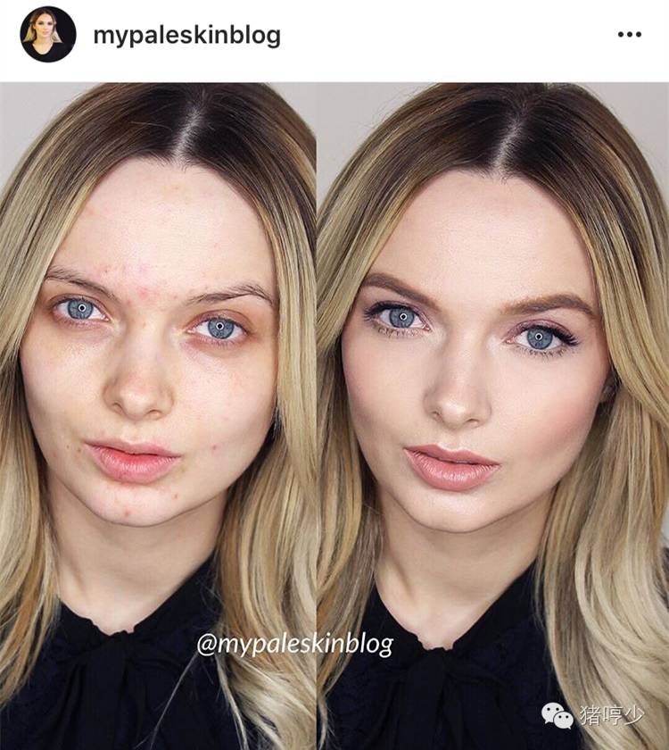 祛痘还是不要和三纲五常斗了，法国顶级皮肤科大夫有话说