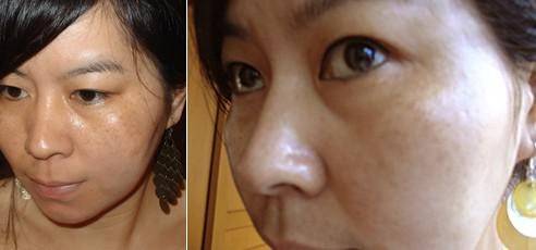 美白丸怎么用才是正确的,真正有效的美白丸产品