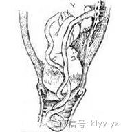 顺产胎儿是横位还是头位,分娩时胎头和骨盆关系