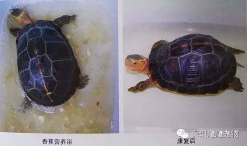 龟水肿的治疗方法,龟水肿是什么症状