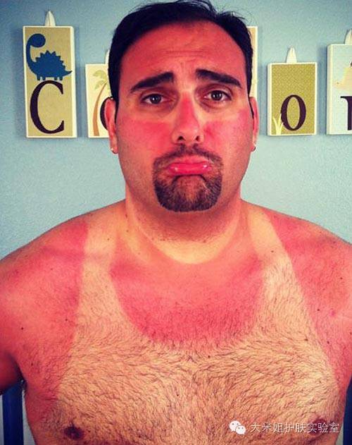 揭秘快速美白祛斑套路,祛斑美白技术视频