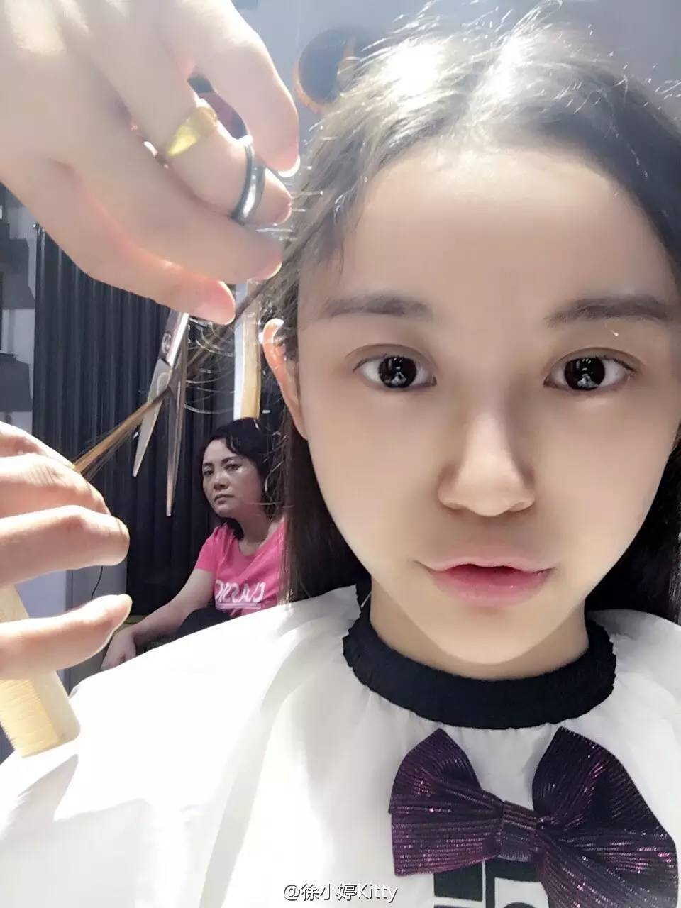 淋巴癌死亡的明星有哪些,30多岁女士淋巴瘤能彻底痊愈吗