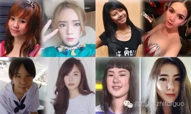 整容失败有多可怕,整容失败多可怕