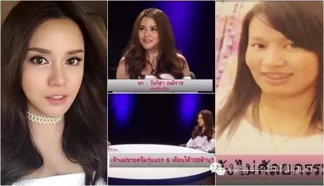 整容失败有多可怕,整容失败多可怕