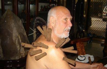 艾灸行业乱象,艾灸传承古法