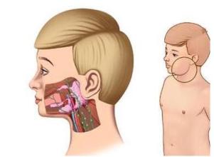 颌下里面长了一个肉瘤不痛,面颊部良性肿物