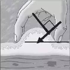 胰岛素注射笔针头选择,胰岛素针头执行标准