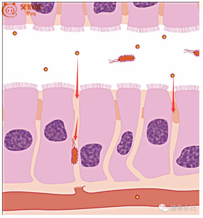 肠道渗漏是什么原因引起的,肠道渗漏怎么检查