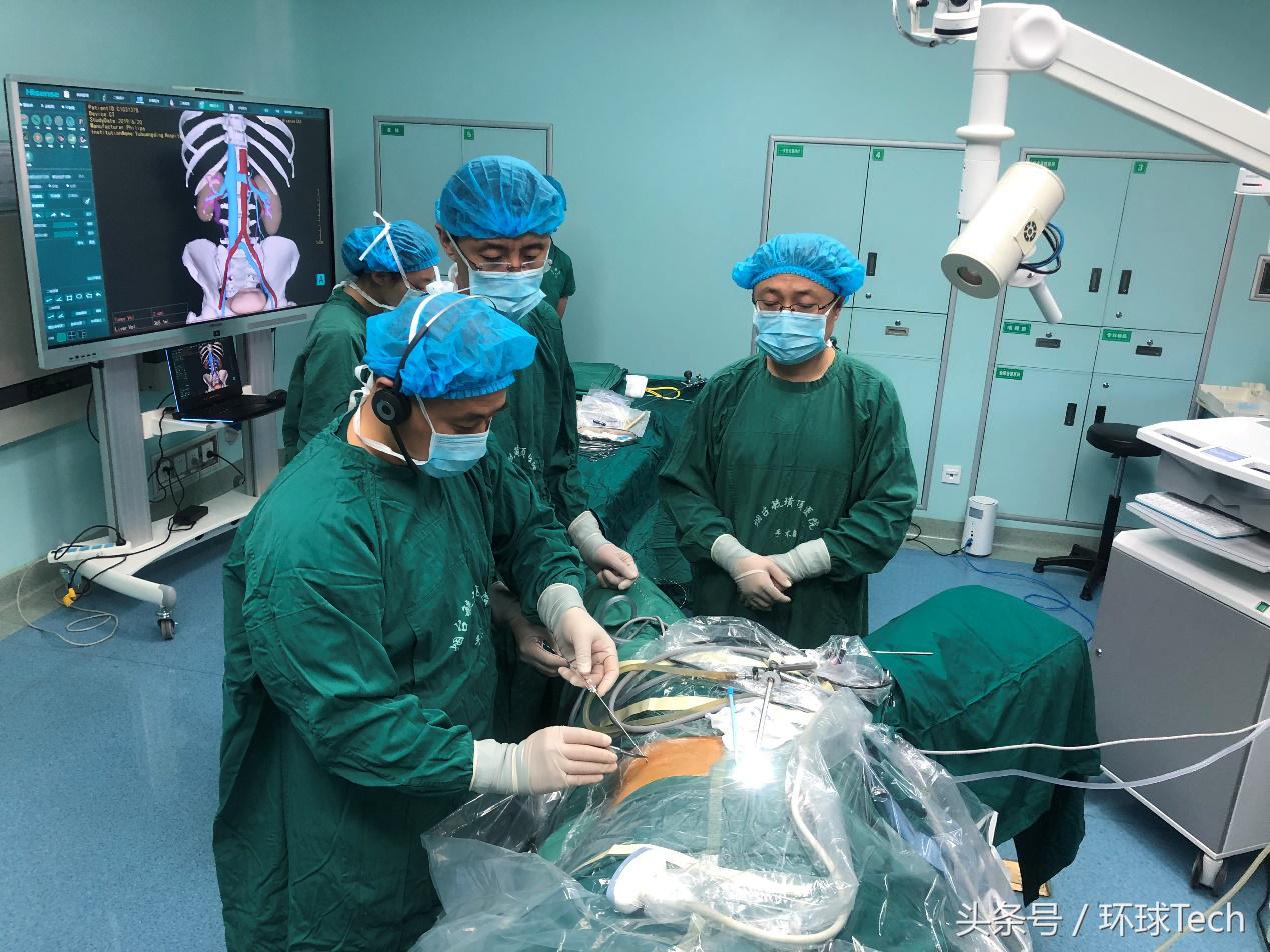 山东省立医院肾结石微创,肾结石3.2厘米微创手术