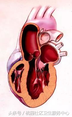 心室支架说明书,这份通俗易懂的心室说明书请收好