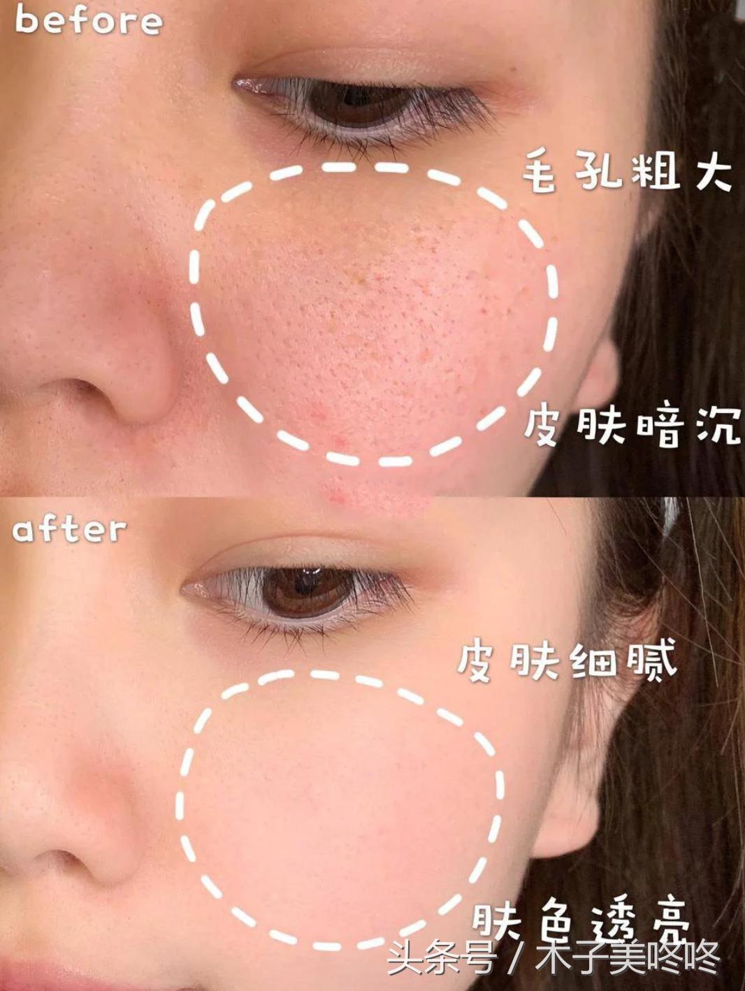 还有哪些鸡肋的网红洗面奶,烂脸的爆红洗面奶